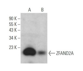 ZFAND2A Antibody (D-11) - Western Blotting - Image 371885 