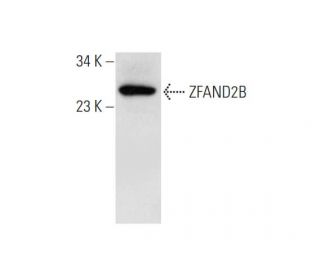 ZFAND2B Antibody (A-11) - Western Blotting - Image 344163 