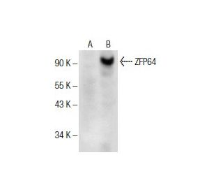 ZFP64 Antibody (C-3) - Western Blotting - Image 154041