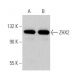 ZHX2 Antibody (D-2) - Western Blotting - Image 367438 