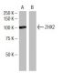 ZHX2 Antibody (Z-07) - Western Blotting - Image 34615