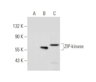 ZIP-kinase Antibody (G-1) - Western Blotting - Image 319918 