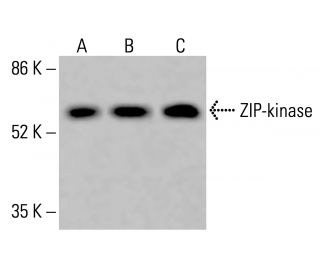 ZIP-kinase Antibody (C-3) - Western Blotting - Image 415621