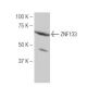 ZNF133 Antibody (9V2) - Western Blotting - Image 53913