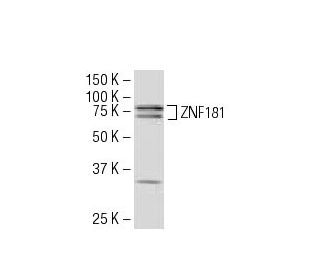 ZNF181 Antibody (16-Z) - Western Blotting - Image 34442