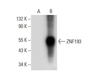 ZNF193 Antibody (F-8) - Western Blotting - Image 308085