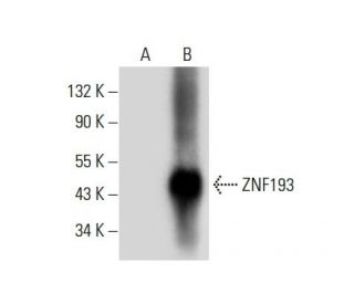 ZNF193 Antibody (G-8) - Western Blotting - Image 308083