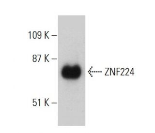 ZNF224 Antibody (2C12) - Western Blotting - Image 384248 