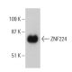ZNF224 Antibody (2C12) - Western Blotting - Image 384248 