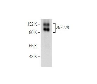 ZNF226 Antibody (A-8) - Western Blotting - Image 155161