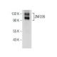 ZNF226 Antibody (A-8) - Western Blotting - Image 155161