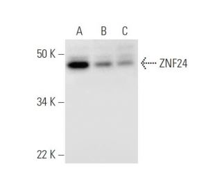 ZNF24 Antibody (H-11) - Western Blotting - Image 294776 