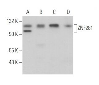 ZNF281 Antibody (G-9) - Western Blotting - Image 373580 