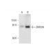 ZNF326 Antibody (F-11) - Western Blotting - Image 288977