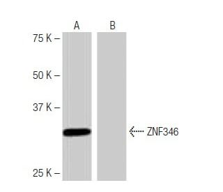 ZNF346 Antibody (LB-L12) - Western Blotting - Image 65108