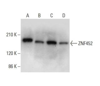ZNF452 Antibody (G-11) - Western Blotting - Image 311737 