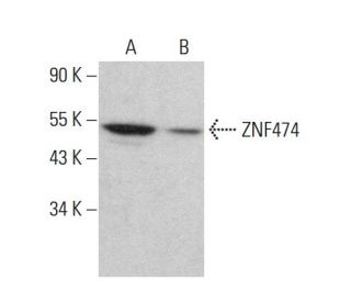 ZNF474 Antibody (C-8) - Western Blotting - Image 379013 