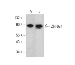 ZNF624 Antibody (F-7) - Western Blotting - Image 346480 