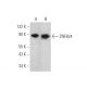 ZNF624 Antibody (F-7) - Western Blotting - Image 346480 