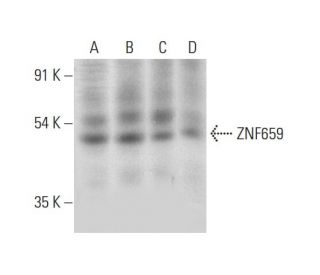 ZNF659 Antibody (C-11) - Western Blotting - Image 314086