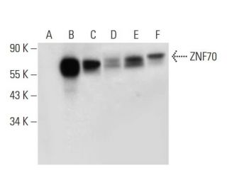 ZNF70 Antibody (F-8) - Western Blotting - Image 309586 