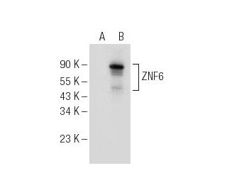 ZNF76 Antibody (A-11) - Western Blotting - Image 154918