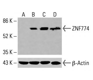 ZNF774 Antibody (E-2) - Western Blotting - Image 416102