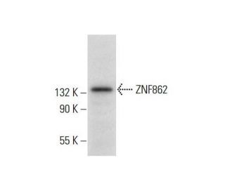 ZNF862 Antibody (A-6) - Western Blotting - Image 308361 