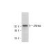ZNF862 Antibody (A-6) - Western Blotting - Image 308361 