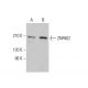 ZNF862 Antibody (A-6) - Western Blotting - Image 379706 