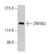 ZNF862 Antibody (A-6) - Western Blotting - Image 387381