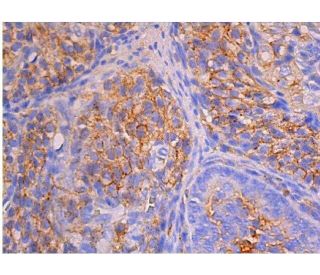 ZO-1 Antibody (R40.76) - Immunohistochemistry - Image 353766 