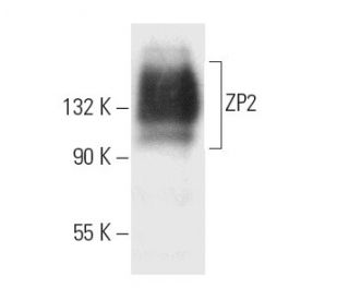 ZP2 Antibody (IE-3) - Western Blotting - Image 9575