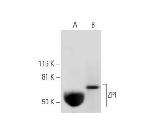 ZPI Antibody (F-12) - Western Blotting - Image 295967
