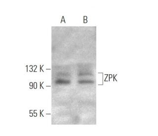 ZPK Antibody (473CT23.12.5) - Western Blotting - Image 374597