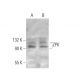 ZPK Antibody (473CT23.12.5) - Western Blotting - Image 374597