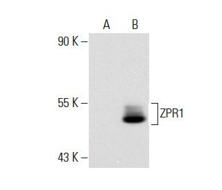 ZPR1 Antibody (LG1) - Western Blotting - Image 45841