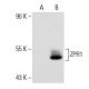 ZPR1 Antibody (LG1) - Western Blotting - Image 45841