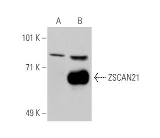 ZSCAN21 Antibody (3418F1a) - Western Blotting - Image 35207 