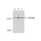 ZSWIM8 Antibody (G-5) - Western Blotting - Image 317940
