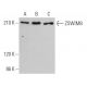 ZSWIM8 Antibody (G-5) - Western Blotting - Image 366674 