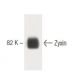 Zyxin Antibody (21) - Western Blotting - Image 60499 